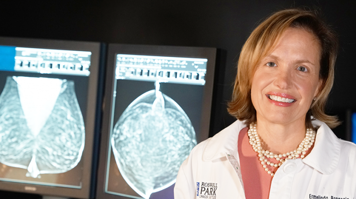 Physician Ermelinda Bonaccio, clinical chief of breast imaging at Roswell Park Cancer Institute in Buffalo.