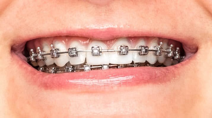 ORTHO