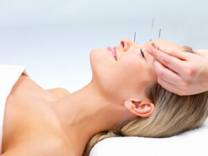 Woman receiving acupuncture treatment on the face